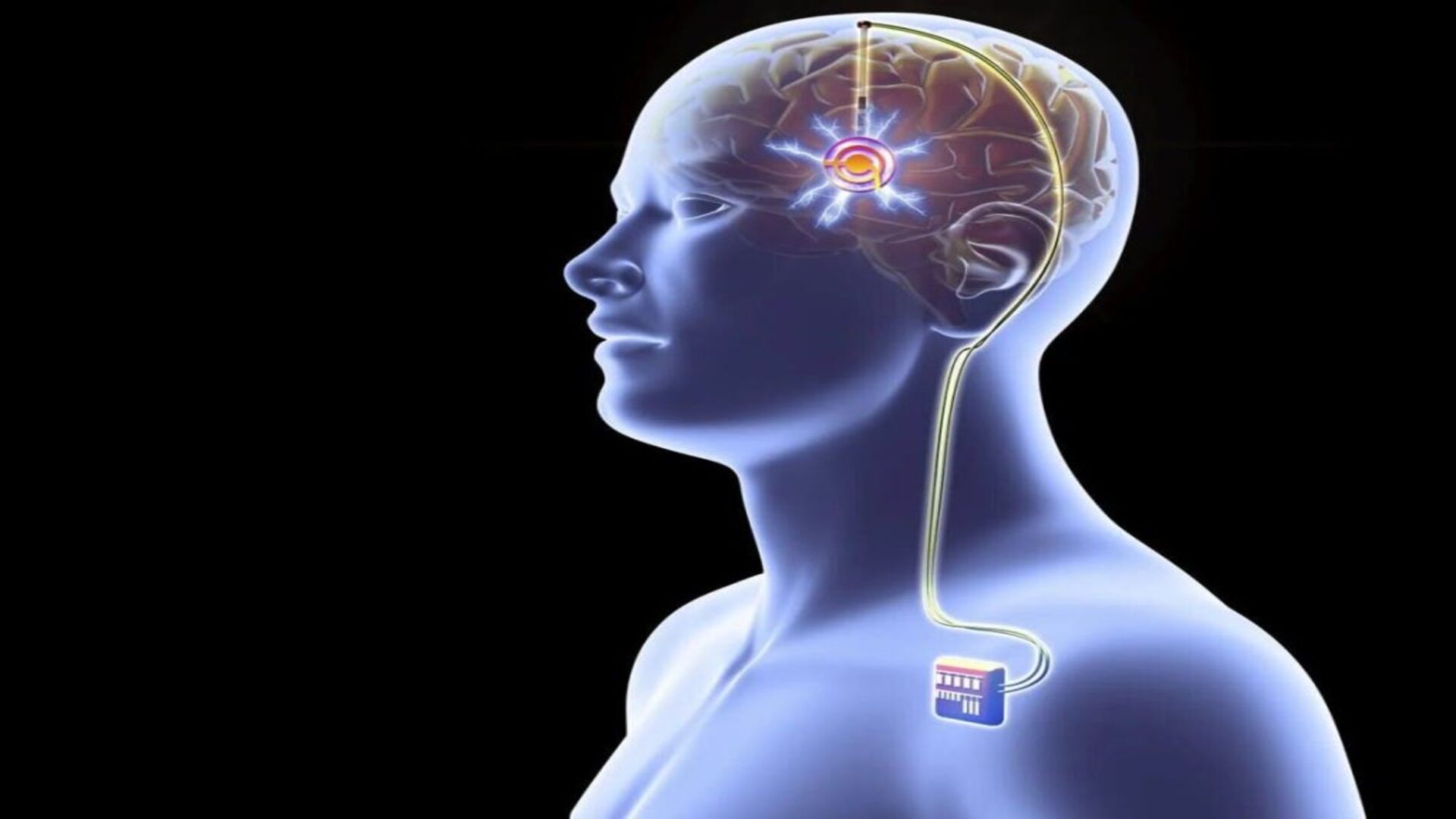 Jornada de educación permanente  para  enfermería:  Enfermedad de Parkinson 