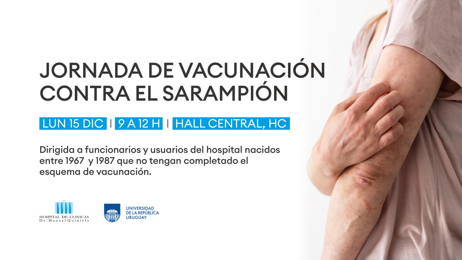 VACUNACIONSARAMPION