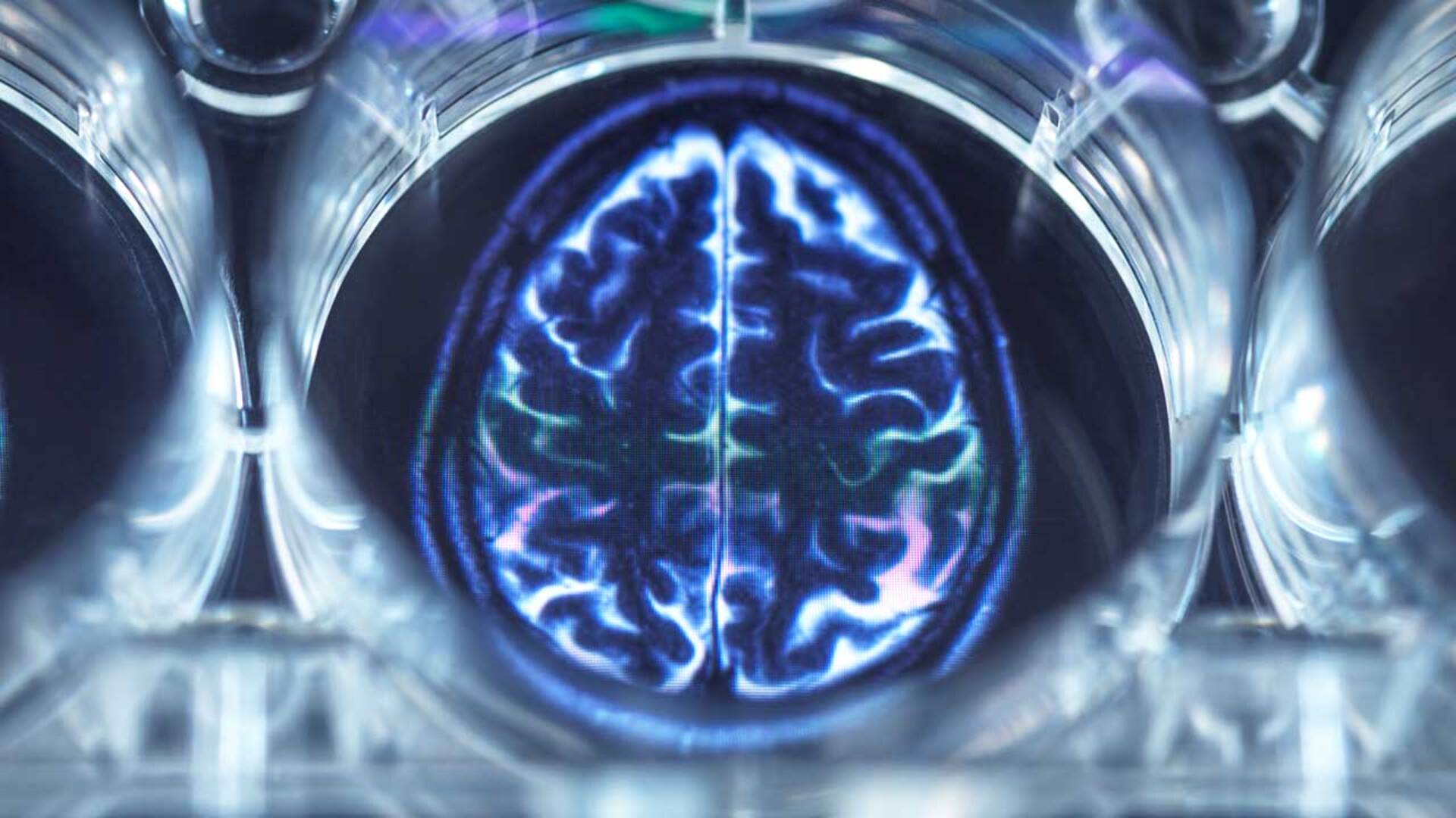 Capacitación  en Neurología y Neurocirugía 
